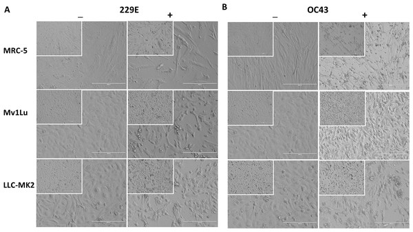 Cell morphology of susceptible cell lines.