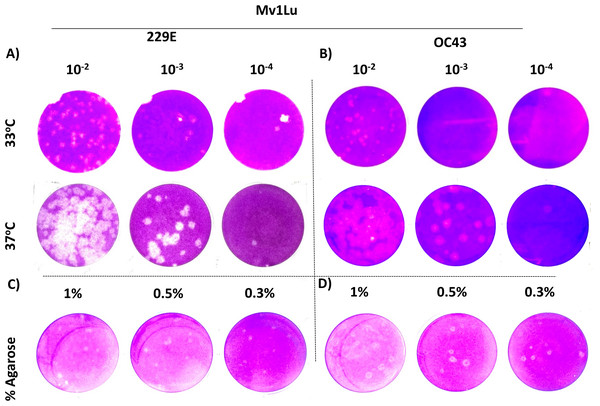 A tune-up for plaque assay conditions of hCoVs.