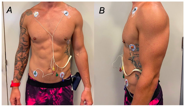 (A and B) Placement of ECG electrodes on participants.