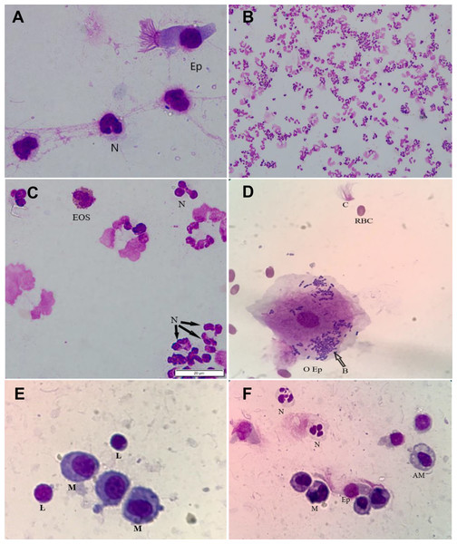 The identification of different cell types in TW and BAL samples.