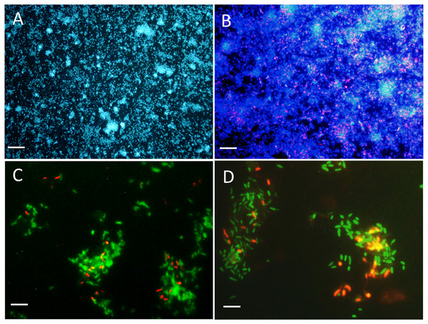 Biofilm visualization by fluorescence in situ hybridization.