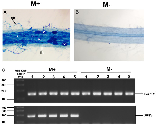 Mycorrhiza colonization of tomato roots.