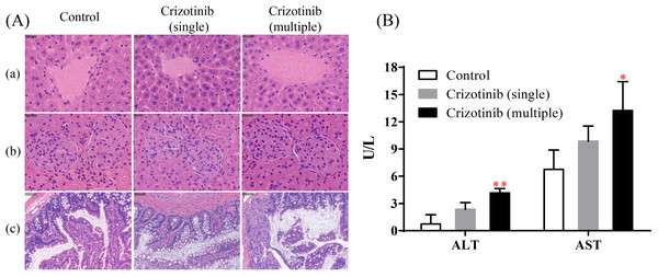 The effect of crizotinib on tissue morphology and liver function.