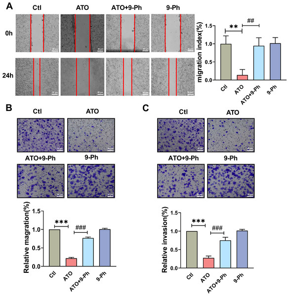 TRPM4 inhibition abolished the ATO-induced decrease in migration and invasion of HCT116 cells.