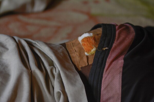 14 year old Abubakar Aminu, who was shot during the recent protest on economic hardship, lies on a mattress at his house In Kano, Nigeria, Thursday, Aug. 8, 2024. (AP Photo/Sani Maikatanga)