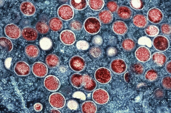 FILE - This image provided by the National Institute of Allergy and Infectious Diseases shows a colorized transmission electron micrograph of monkeypox particles (red) found within an infected cell (blue), cultured in the laboratory that was captured and color-enhanced at the NIAID Integrated Research Facility in Fort Detrick, Md. Kenya and the Central African Republic declared new outbreaks of mpox Wednesday, July 31, 2024, as Africa's health officials are racing to contain the spread of the disease in a region lacking vaccines. (NIAID via AP, File)