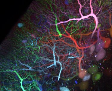 Cerebellum CNS 1