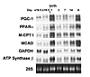 Induction of PGC-1 gene expression during perinatal cardiac development. Th