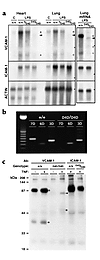 VCAM-1 expression in Vcam1D4D/D4D mice. (a) Northern blot analysis of VCAM-