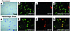 Expression of ORP150 in human brain: effect of excitatory and nutritional s