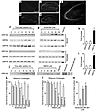 Expression of ORP150 in mouse hippocampus and cultured neurons in response