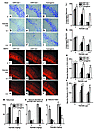 Role of ORP150 in the neuronal response to kainate. Either Nissl (a–k) or i