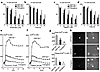 Role of ORP150 in stress response to glutamate in vitro. (a–d) Cultured hip