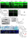 Netrin-1 from osteoclasts induces axonal growth.