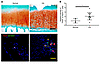 Osteoclast-derived netrin-1 is elevated in human OA subchondral bone.