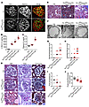 Doxycycline-inducible podocyte-specific Tln1-KO mice have massive proteinur