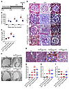 VPA reduces podocyte injury in Dox-inducible Tln1fl/fl Pod-rtTA TetO-Cre mi