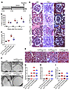 SAHA reduces podocyte injury in Dox-inducible Tln1fl/fl Pod-rtTA TetO-Cre m