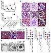 Podocyte deletion of Hdac1 and Hdac2 improves glomerulosclerosis and kidney