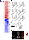 VPA treatment mitigates CREB-mediated EGR1 upregulation in Tln1fl/fl Pod-rt