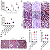 Loss of EGR1 in Tln1fl/fl Pod-rtTA TetO-Cre mice improves glomerulosclerosi