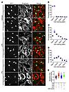 Loss of EGR1 stabilizes and maintains actin stress fibers following LPS or