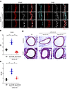 miR-223 modulates Pdgfrβ expression and intimal hyperplasia in vivo after f