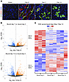 Transcriptional profiling of injured tubular epithelial cells.