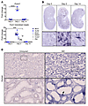 Foxm1 is expressed after kidney injury in mouse and human.