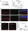 cAMP induces neogenin expression in the retina.