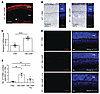 cAMP promotes photoreceptor cell death through neogenin.