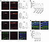 Elevated neogenin expression in Rd1 and Rd10 photoreceptors.