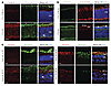 Neogenin induction in degenerating Rd1 rods, Rd1 cones, and human photorece