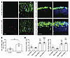 Neogenin is sufficient and required to induce photoreceptor cell death.