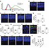 Blocking neogenin promotes photoreceptor survival.