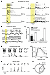 Improved feature detection in 4Ig-treated Rd1 eyes.