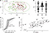 The bile acid distribution in patients with CDI resembles that of a charact