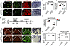 Loss of NFIA from astrocytes delays oligodendrocyte differentiation after W