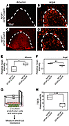 NFIA-deficient astrocytes exhibit impaired BBB remodeling after WMI.