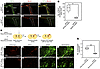 Selective deletion of NFIA in the SVZ impairs reactive astrocyte production