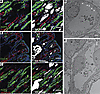 Nephrocalcinosis occurs within the loops of Henle of Cldn2–/y mice.