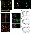 GAS induces stromal and immune cell death via processes involving SLO and o