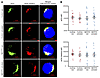 Mitochondrial mass and membrane potential do not differ between healthy con