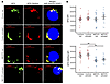 Mitochondrial membrane potential is decreased in CD8+ T cells from patients