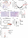 Snai1 and Ly6a (Sca-1) mark a subpopulation of αPD-1 immunotherapy persiste