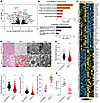 NAFLD patients exhibit liver mitochondria dysfunction.