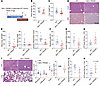 Increase in TREM2 gene dosage reduces steatohepatitis and sepsis-induced li