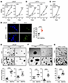 MAPK4 overexpression promotes PCa cell growth.