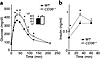 Response of blood glucose (a) and insulin (b) to a glucose load in CD36-nul