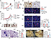 Loss of tumor cell–specific GLS reduces tumor growth and metastasis in a ly